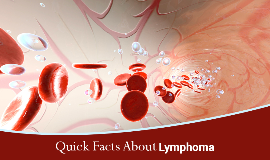 Quick Facts About Lymphoma